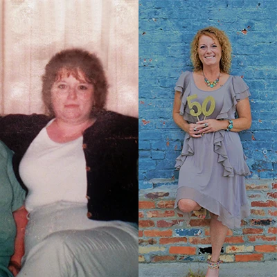 Angela L. - Before and After